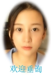 �캣̩�_(d��)